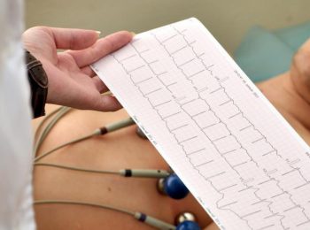 Cardiologista em Fortaleza e Maracanaú | ICCardio Eletrocardiograma ecocardiograma
