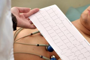 Cardiologista em Fortaleza e Maracanaú | ICCardio Eletrocardiograma ecocardiograma